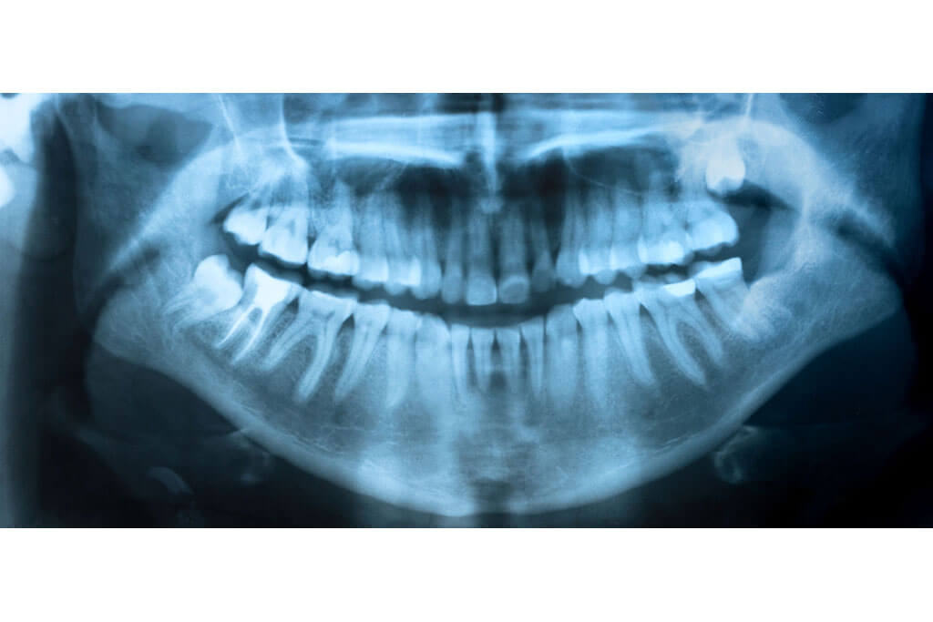 X-ray Radiation Examination